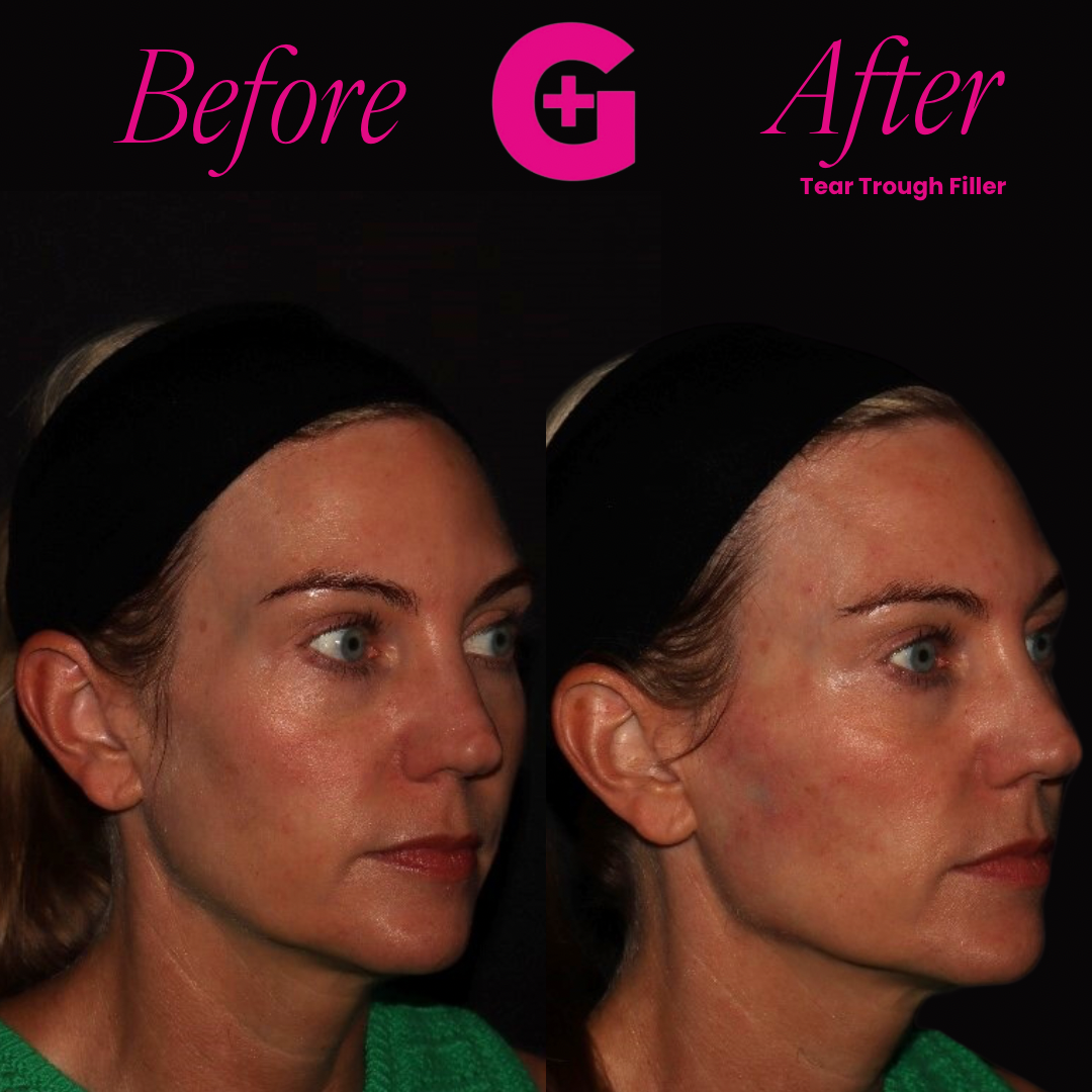 before and afters - 19