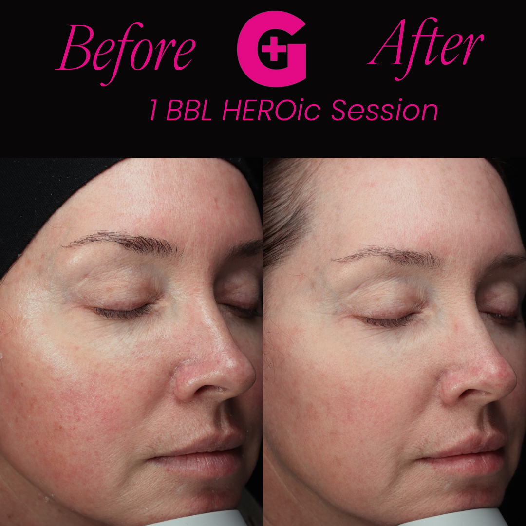 before and afters - 21