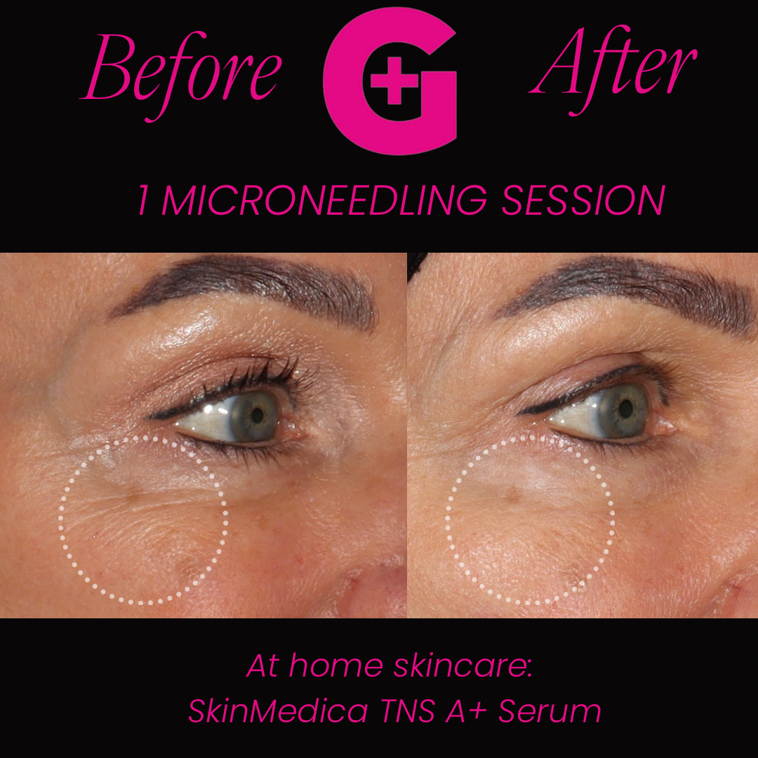 before and afters - 22