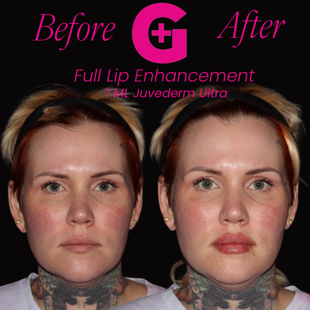 before and afters - 24