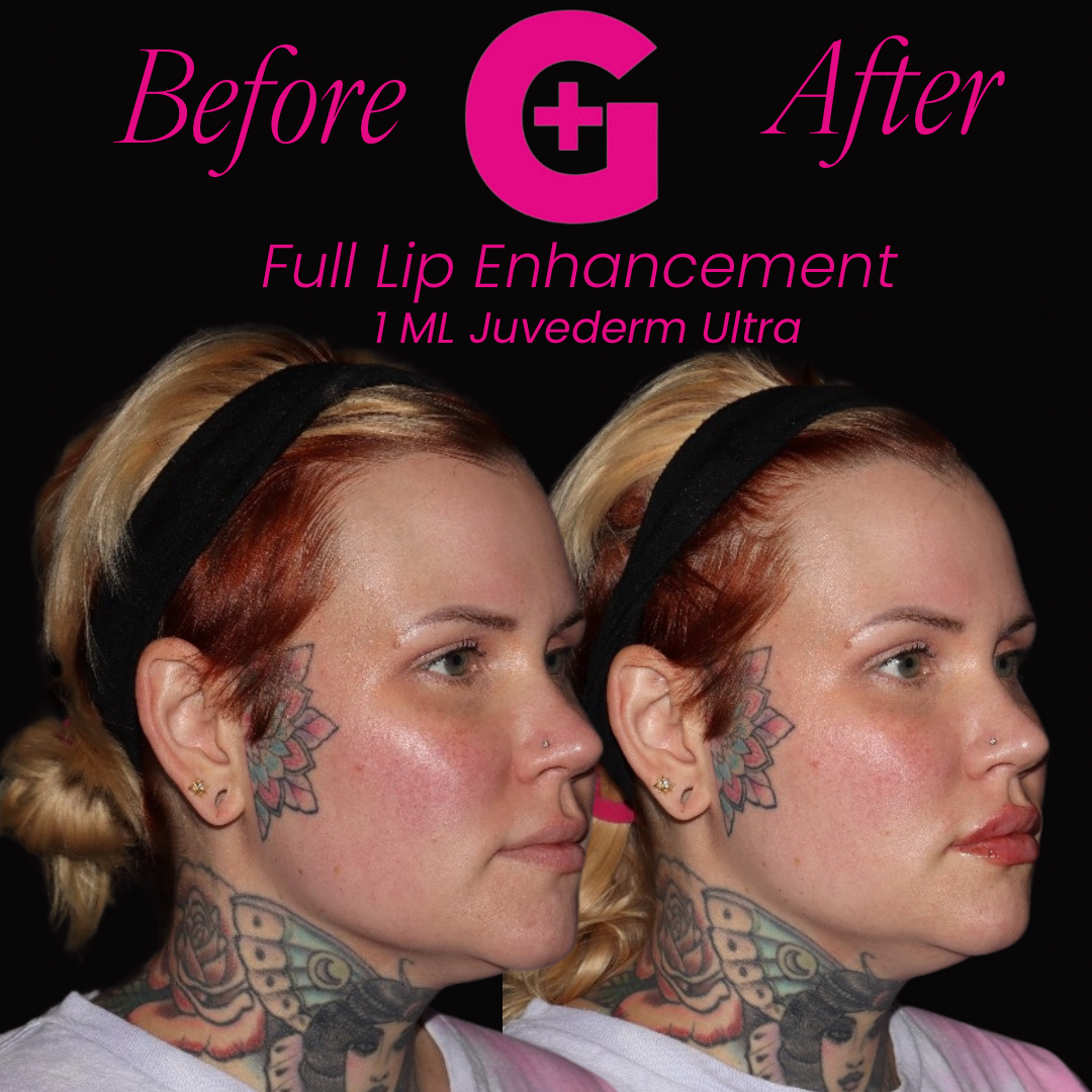 before and afters - 25
