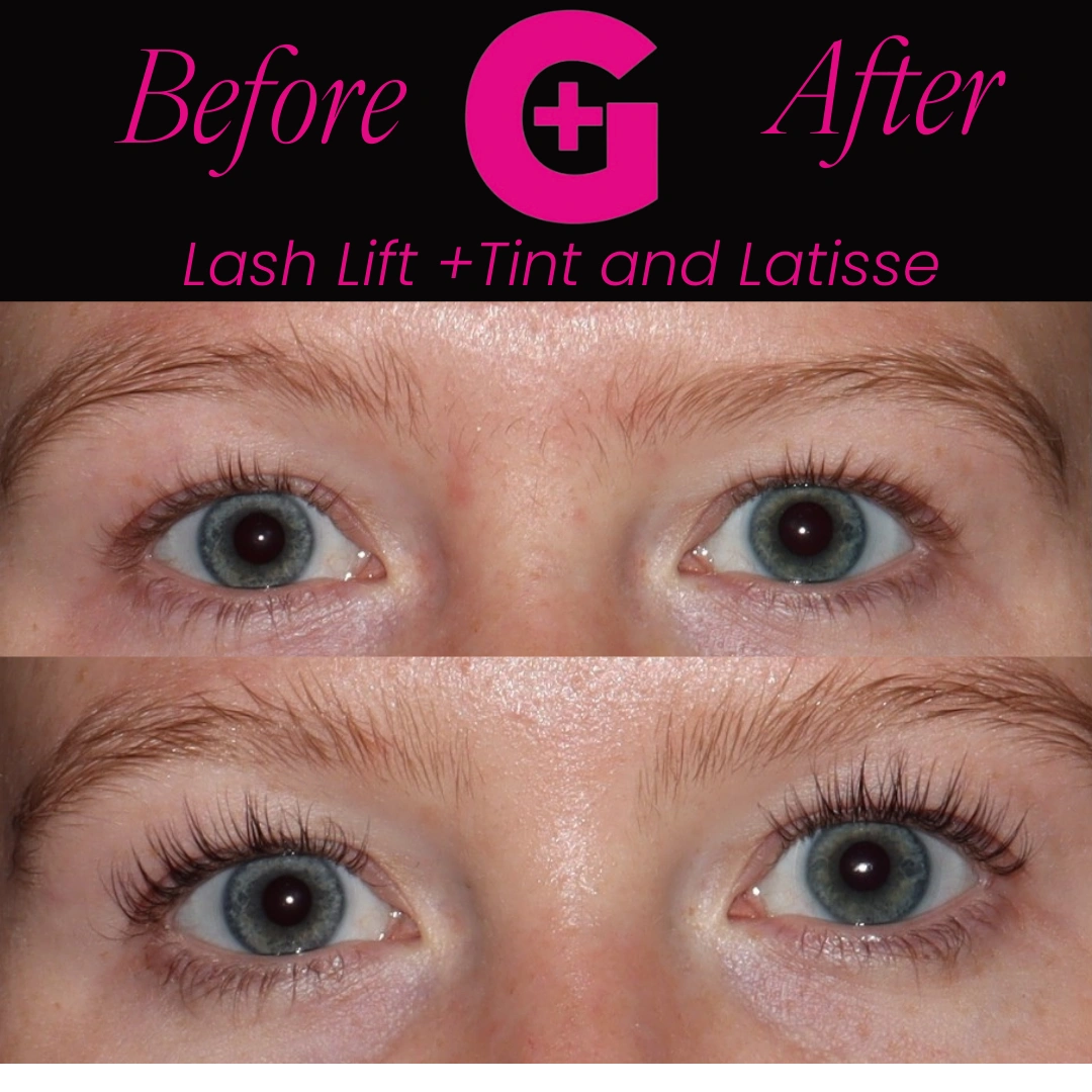 Lash-Lift-and-Tint-b-and-a