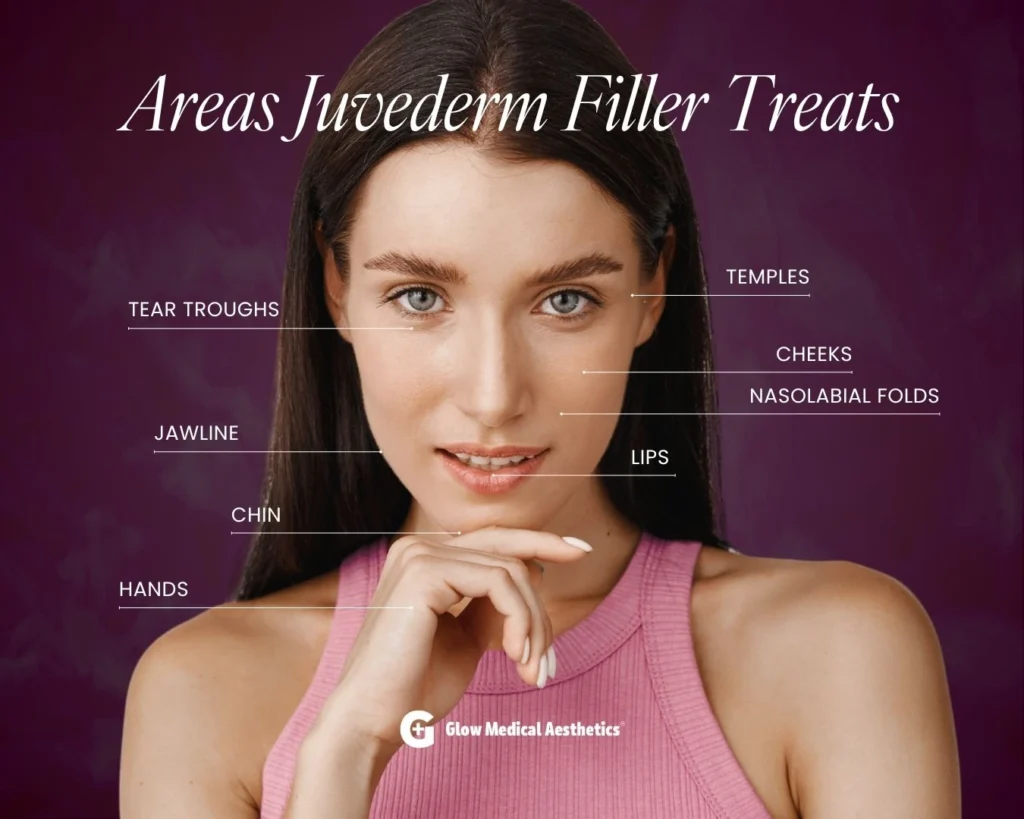 Areas Juvederm Filler Treats