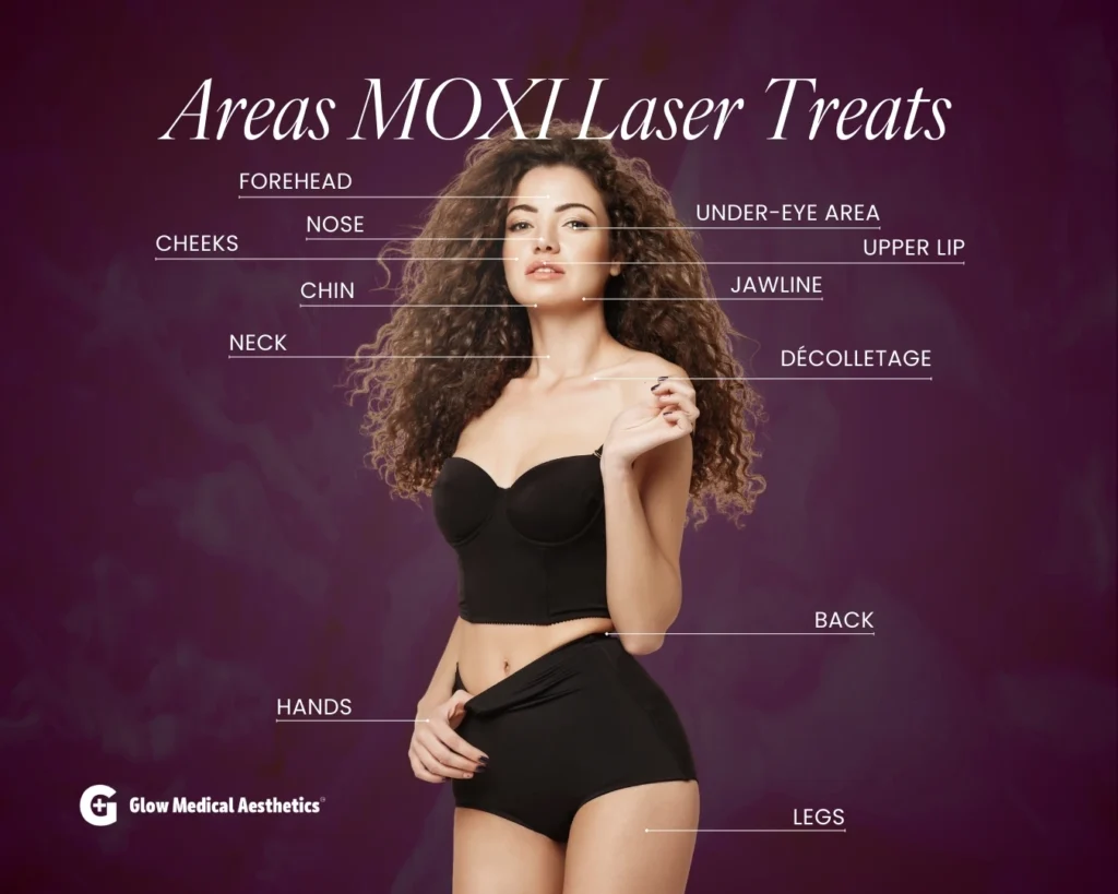 Areas MOXI Laser Treats