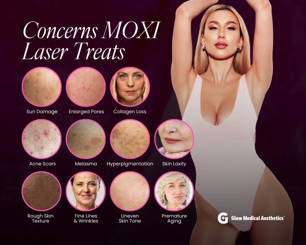 Concerns MOXI Laser Treats