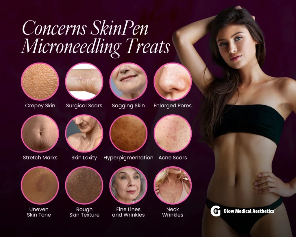 Concerns SkinPen Microneedling Treats