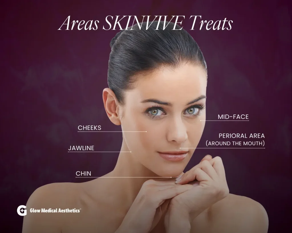 Areas Skinvive treats