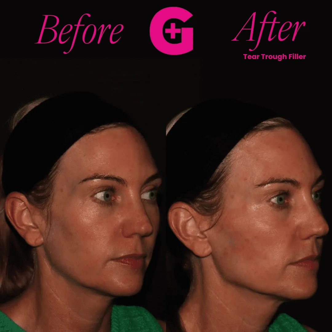 before-and-afters-19