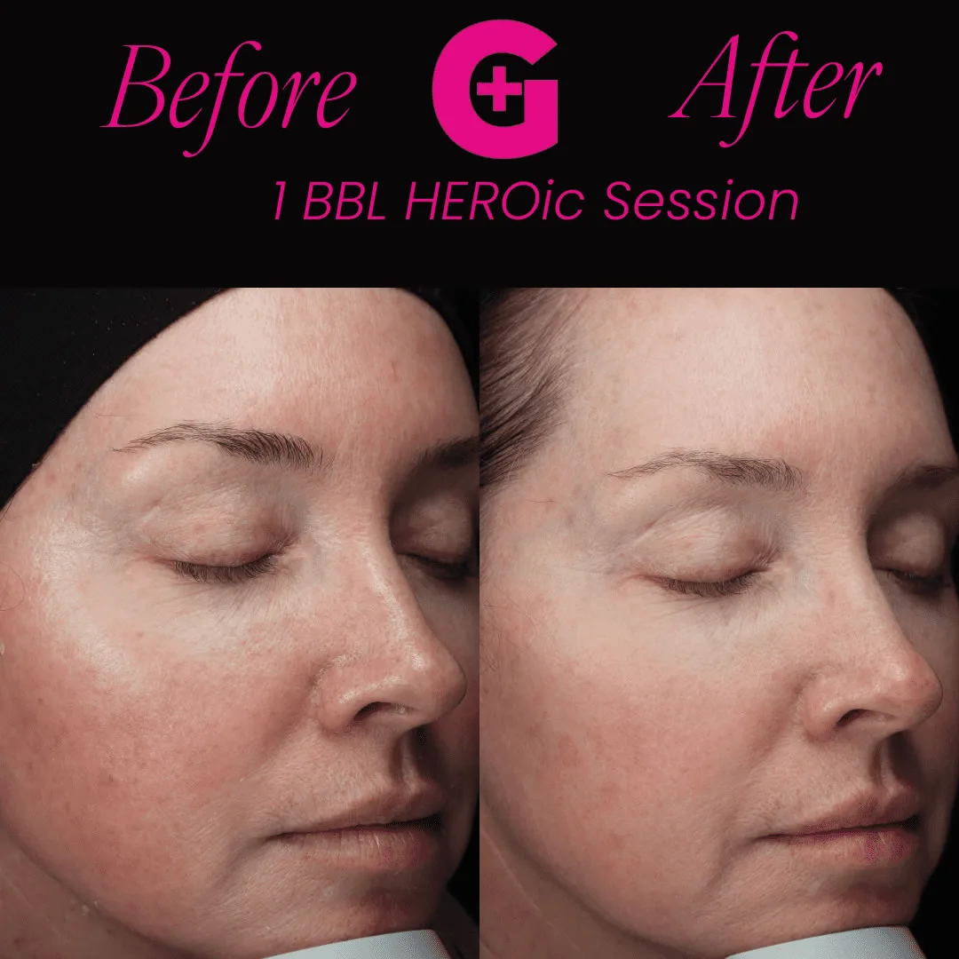 before-and-afters-21