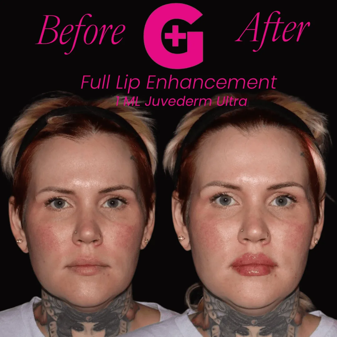 before-and-afters-24