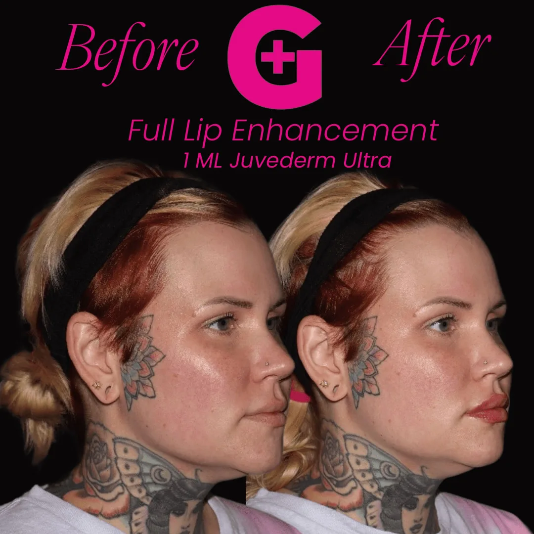 before-and-afters-25