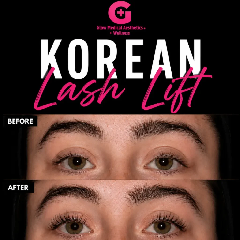 lashes